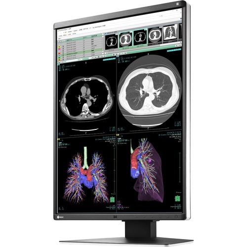 Eizo RadiForce RX360 21.3
